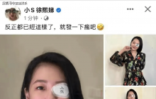 小S疑似被家暴左眼淤青，大S被爆结婚时刚刚流产 